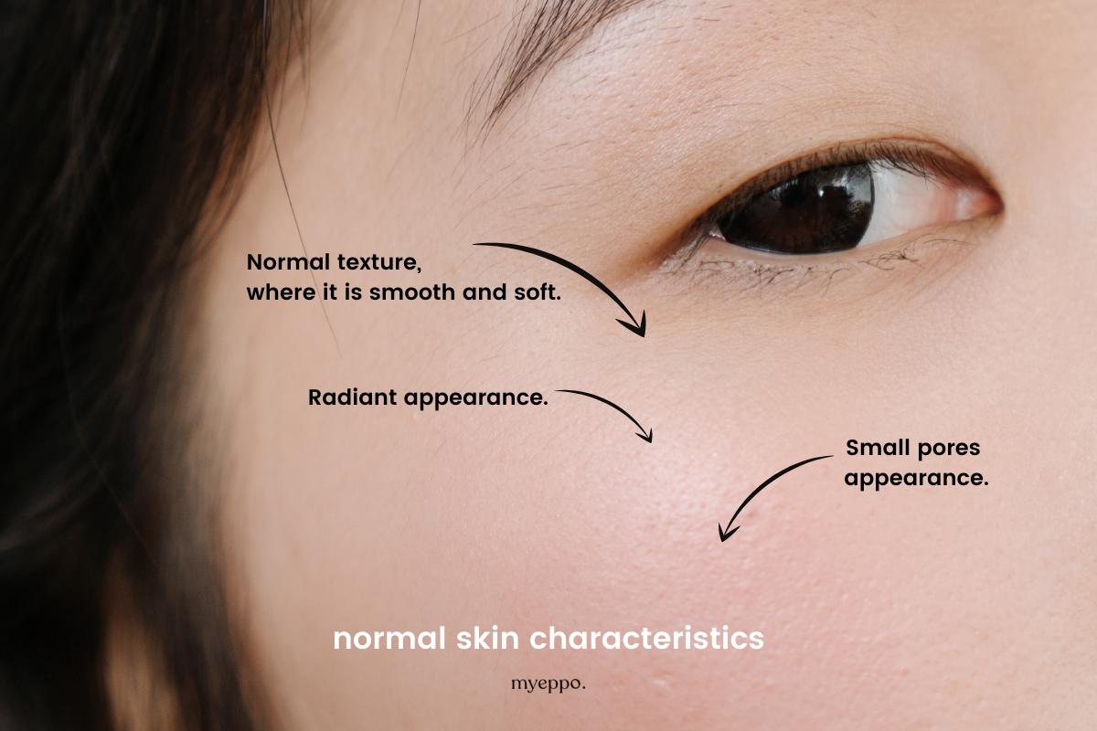 normal skin charanormal skin characteristics myeppocteristics myeppo