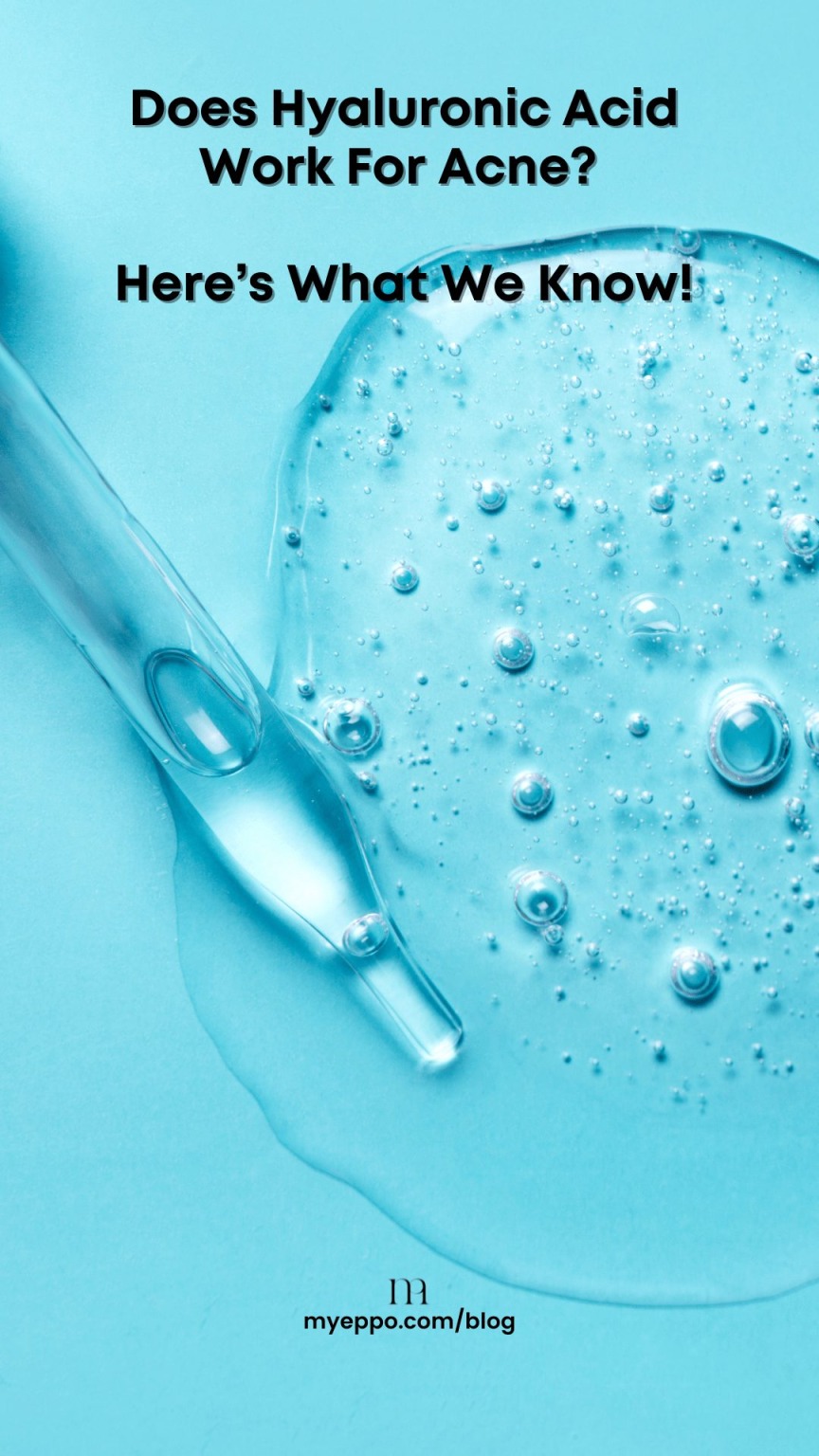 Does Hyaluronic Acid Work For Acne? Here’s What We Know! myeppo.